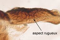 Aphis ervi : tergite rugueux