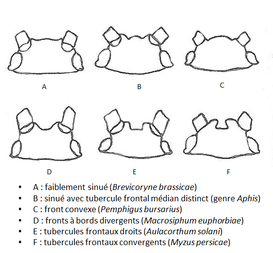 Différentes formes des sinus frontaux